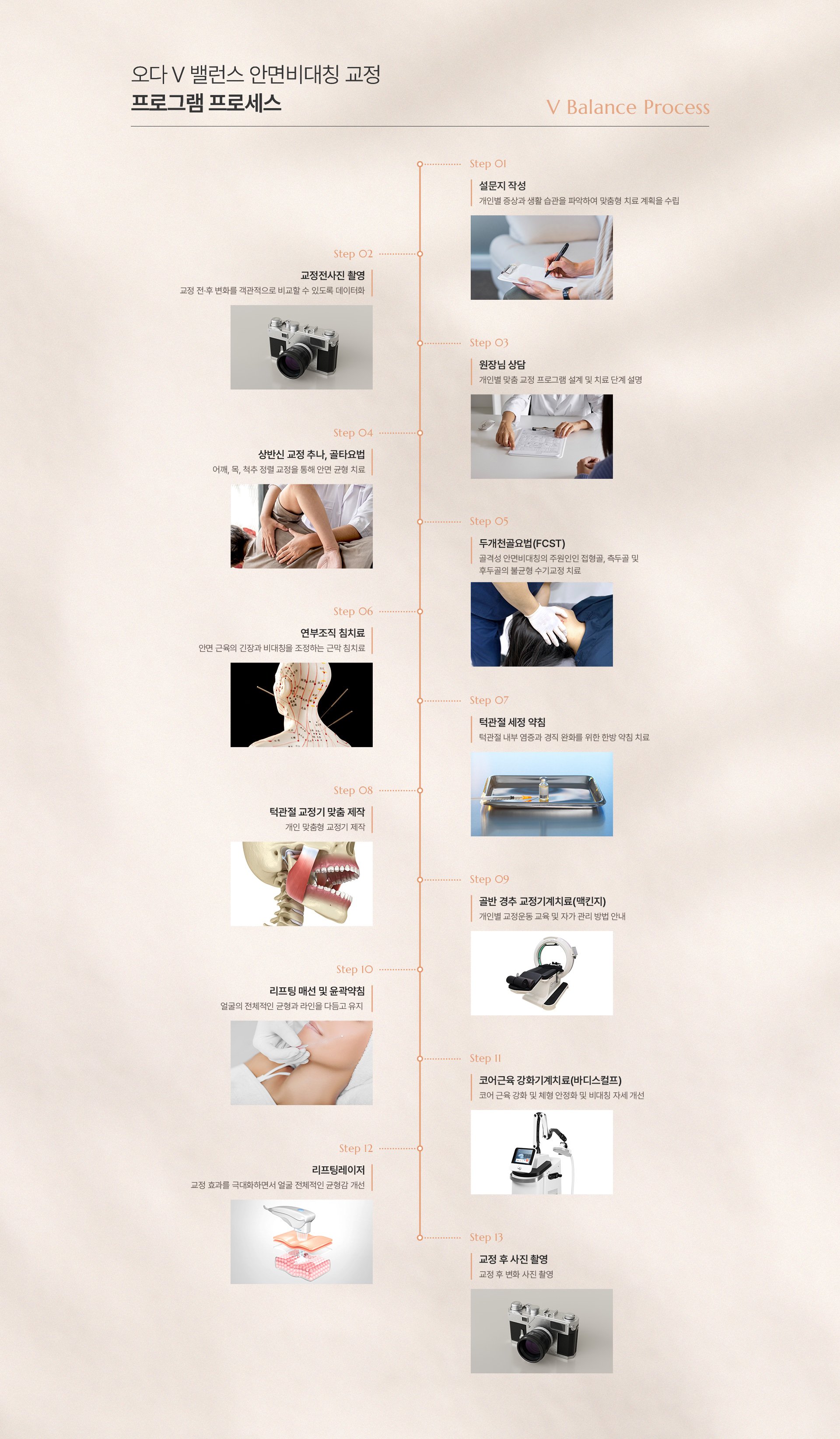 안면비대칭 교정 상세04